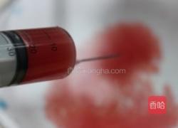 西瓜鱼籽粒的做法图解6